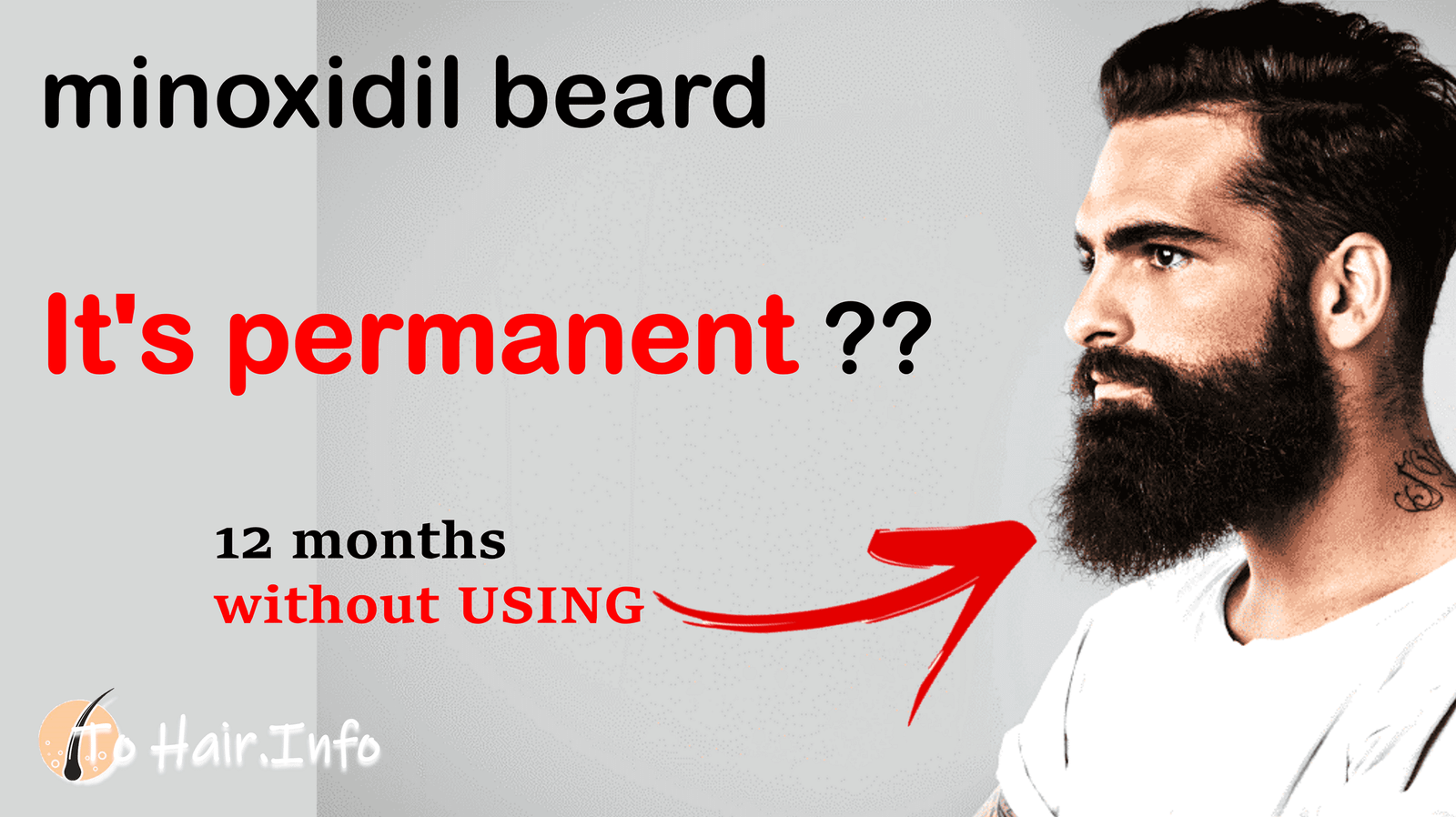minoxidil beard It's permanent ??