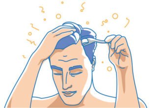 dermaroller alopecia